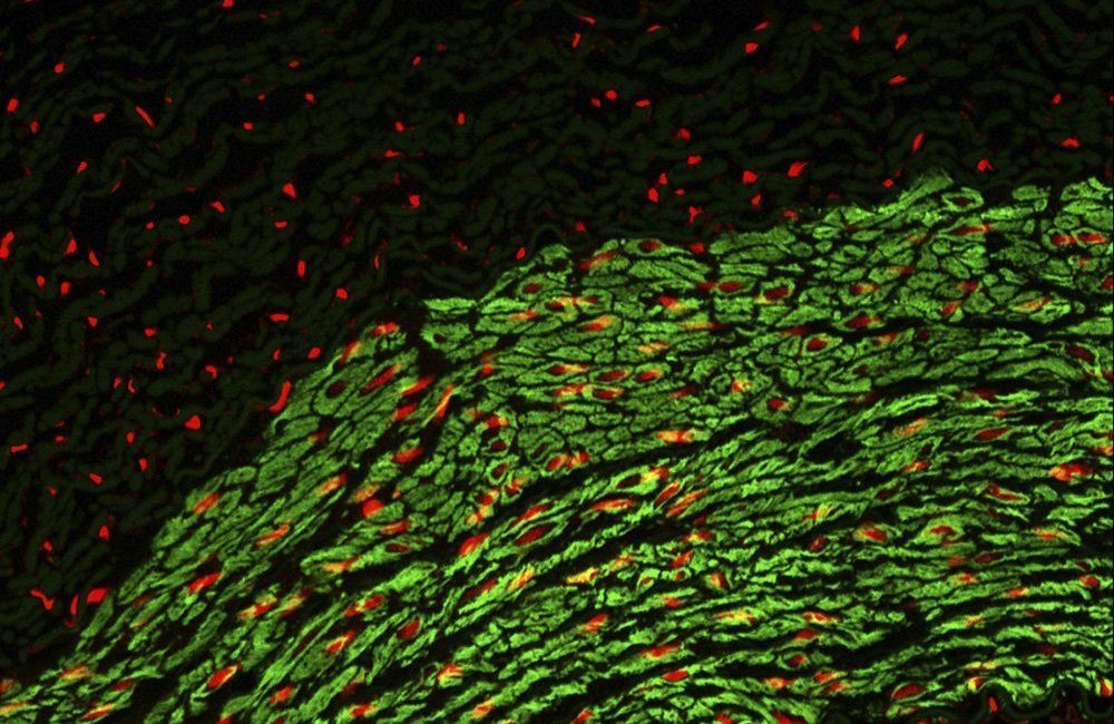 Microscopy and spectroscopy concept representing broadband excitation with SuperK FIANIUM laser. Green spectroscopy