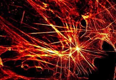 STED Microscopy