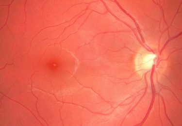 Quantum OCT Pushes the Limits of Eye Imaging