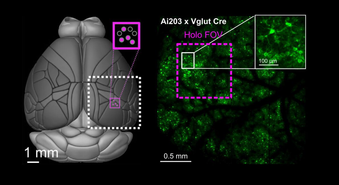 A mesoscale image of a mouse brain taken by a research team at UC Berkeley